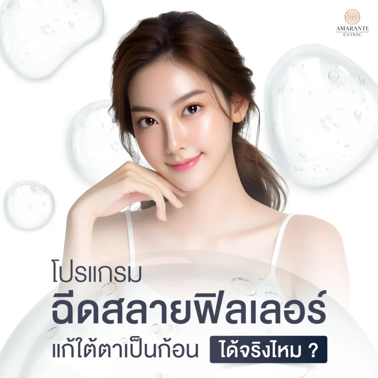 ฉีดสลายฟิลเลอร์แก้ใต้ตาเป็นก้อนได้จริงไหม?