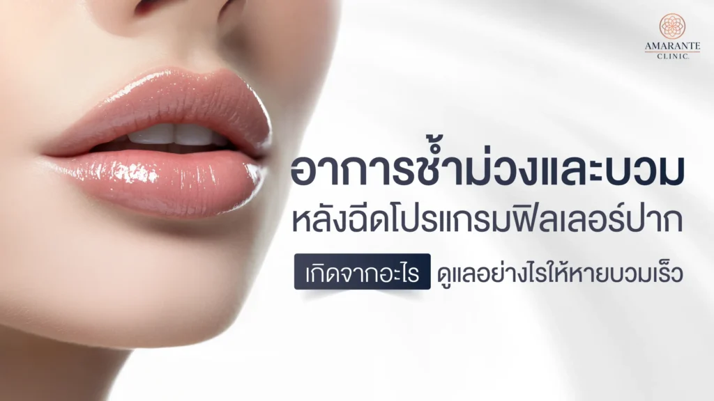 อาการช้ำม่วงและบวม หลังฉีดฟิลเลอร์ที่ปาก เกิดจากอะไร ดูแลอย่างไร