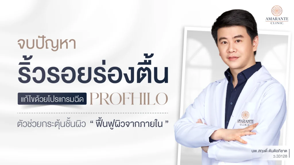 ปกภาพบทความ ปัญหาริ้วรอยร่องตื้น แก้ไขได้ด้วย Profhilo ตัวช่วยกระตุ้นชั้นผิว