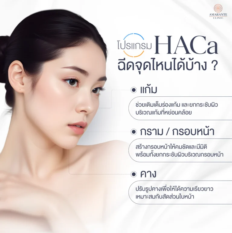 ภาพ infographic อธิบาย HArmonyCa ฉีดจุดไหนได้บ้าง