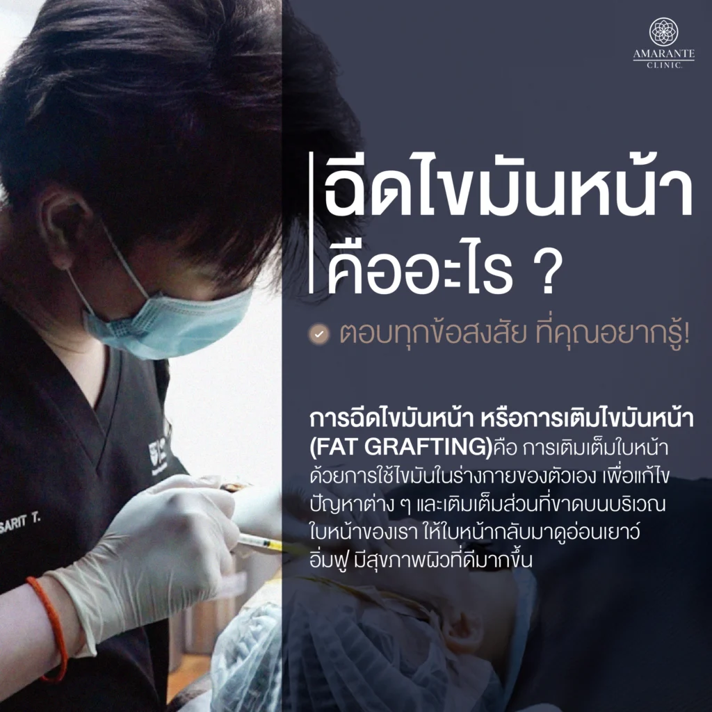 ฉีดไขมันหน้า คืออะไร? ตอบทุกข้อสงสัยที่คุณอยากรู้