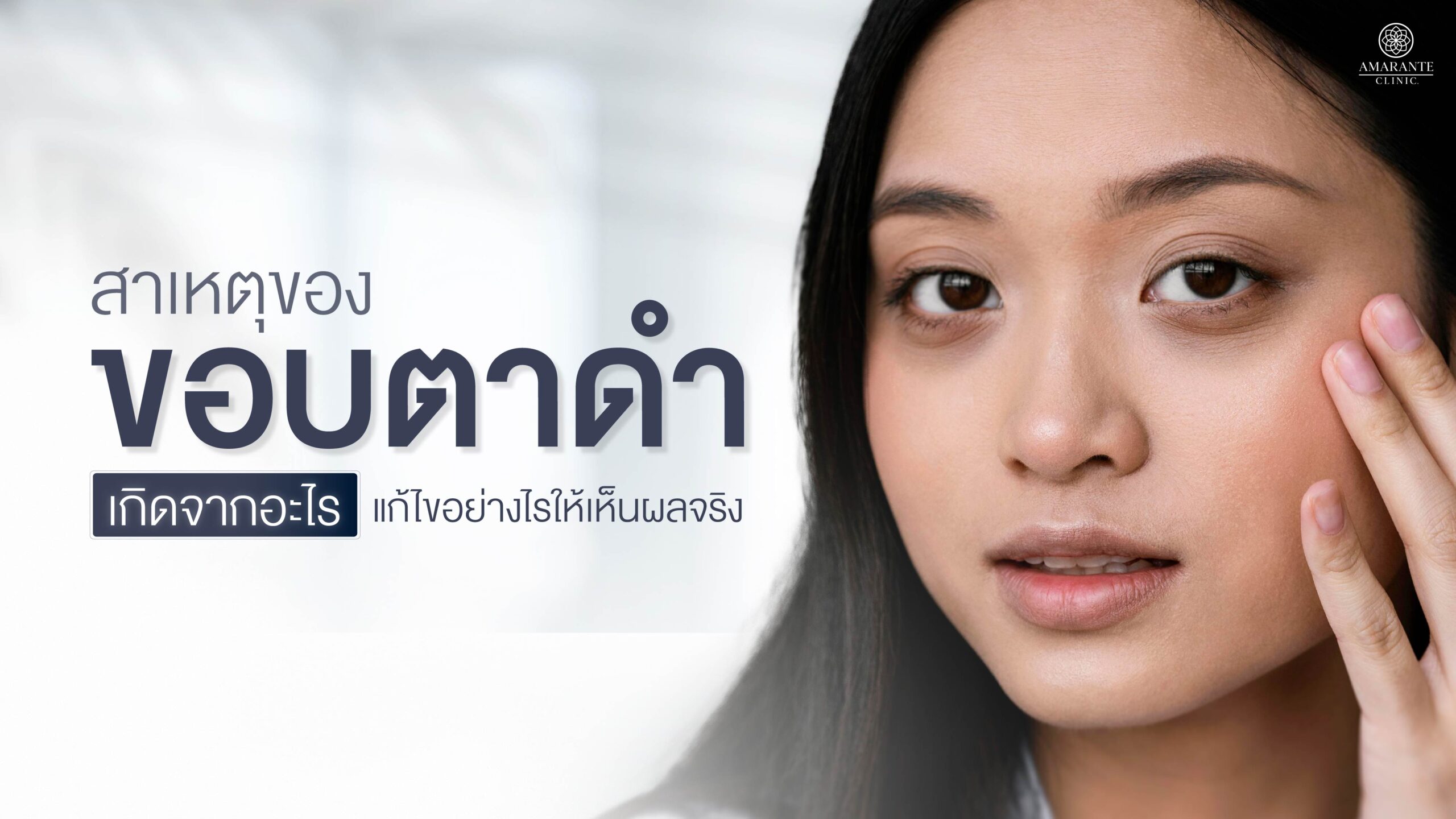 ปกภาพบทความ สาเหตุของขอบตาดำเกิดจากอะไรและวิธีแก้ที่เห็นผล