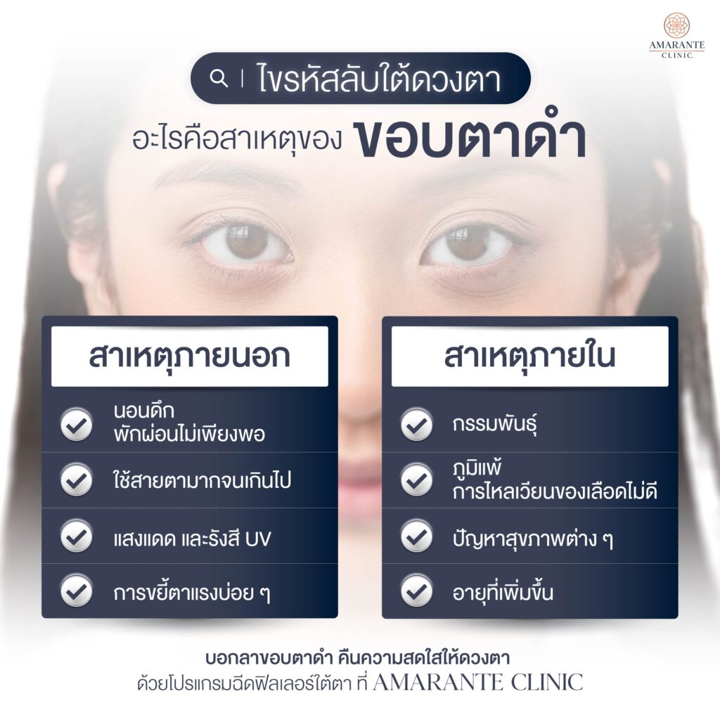 อะไรคือสาเหตุของขอบตาดำ