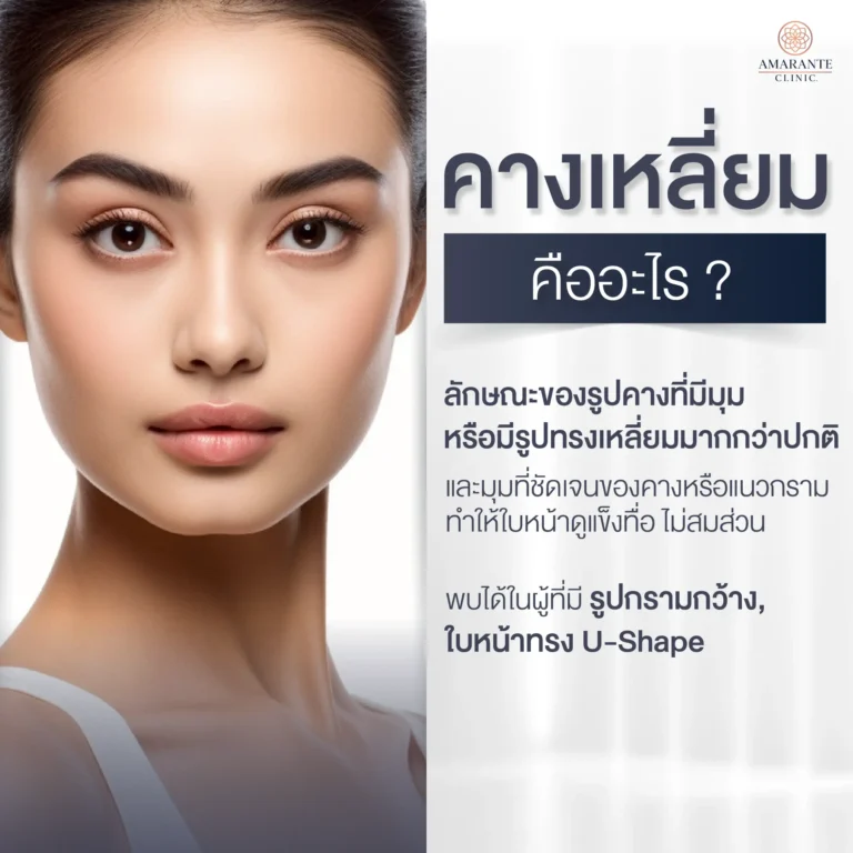 คางเหลี่ยม คืออะไร