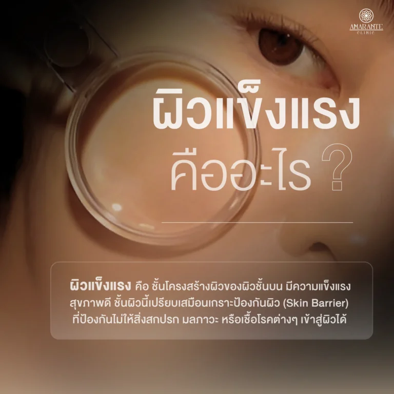 ผิวแข็งแรง คืออะไร​