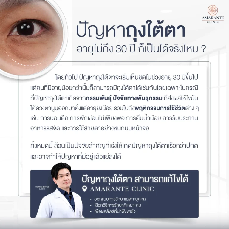 อายุไม่ถึง 30 ปี แต่พบปัญหาถุงใต้ตา