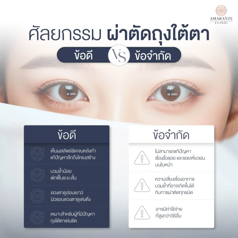 ข้อดี - ข้อเสีย การแก้ปัญหาถุงใต้ตาด้วยวิธีการผ่าตัด