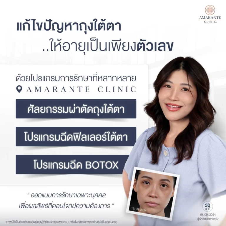 แก้ไขปัญหาถุงใต้ตาทั้งฉีดฟิลเลอร์และผ่าตัดถุงใต้ตา ที่ Amarante Clinic