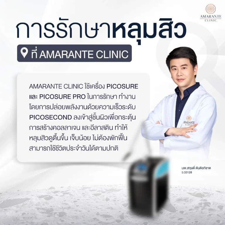 รักษาหลุมสิวที่ Amarante Clinic