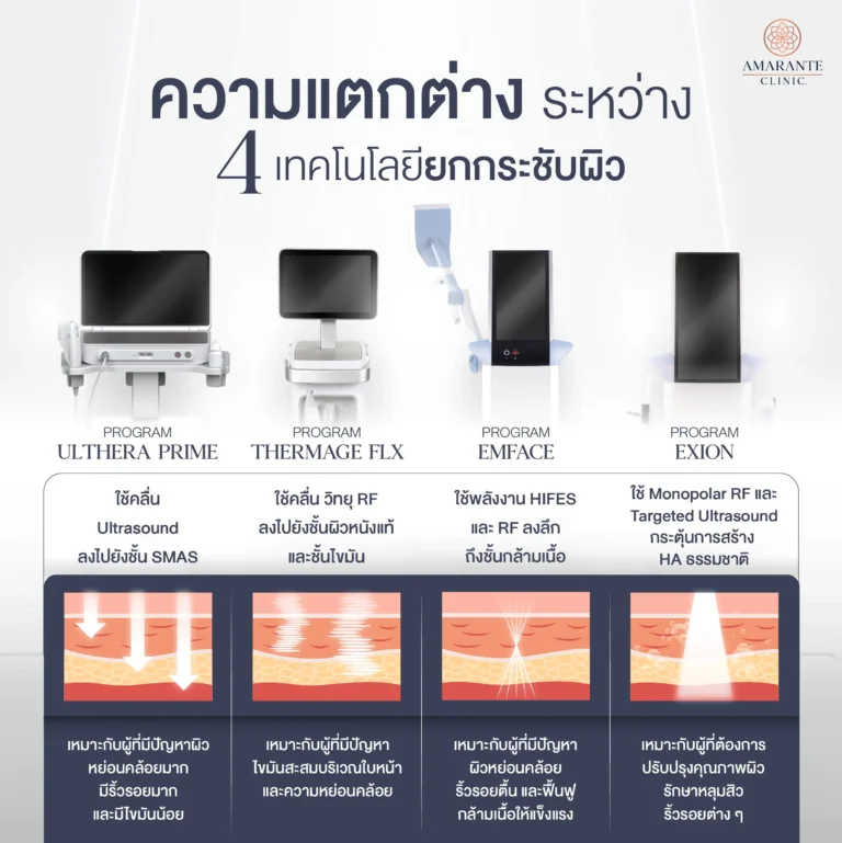 Ulthera Prime แตกต่างจาก Thermage, Emface, Exion อย่างไร