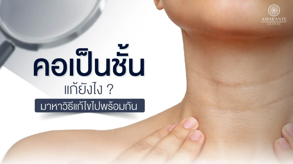 ปกภาพบทความ คอเป็นชั้น แก้ยังไง มาหาวิธีแก้ไขไปพร้อมกัน