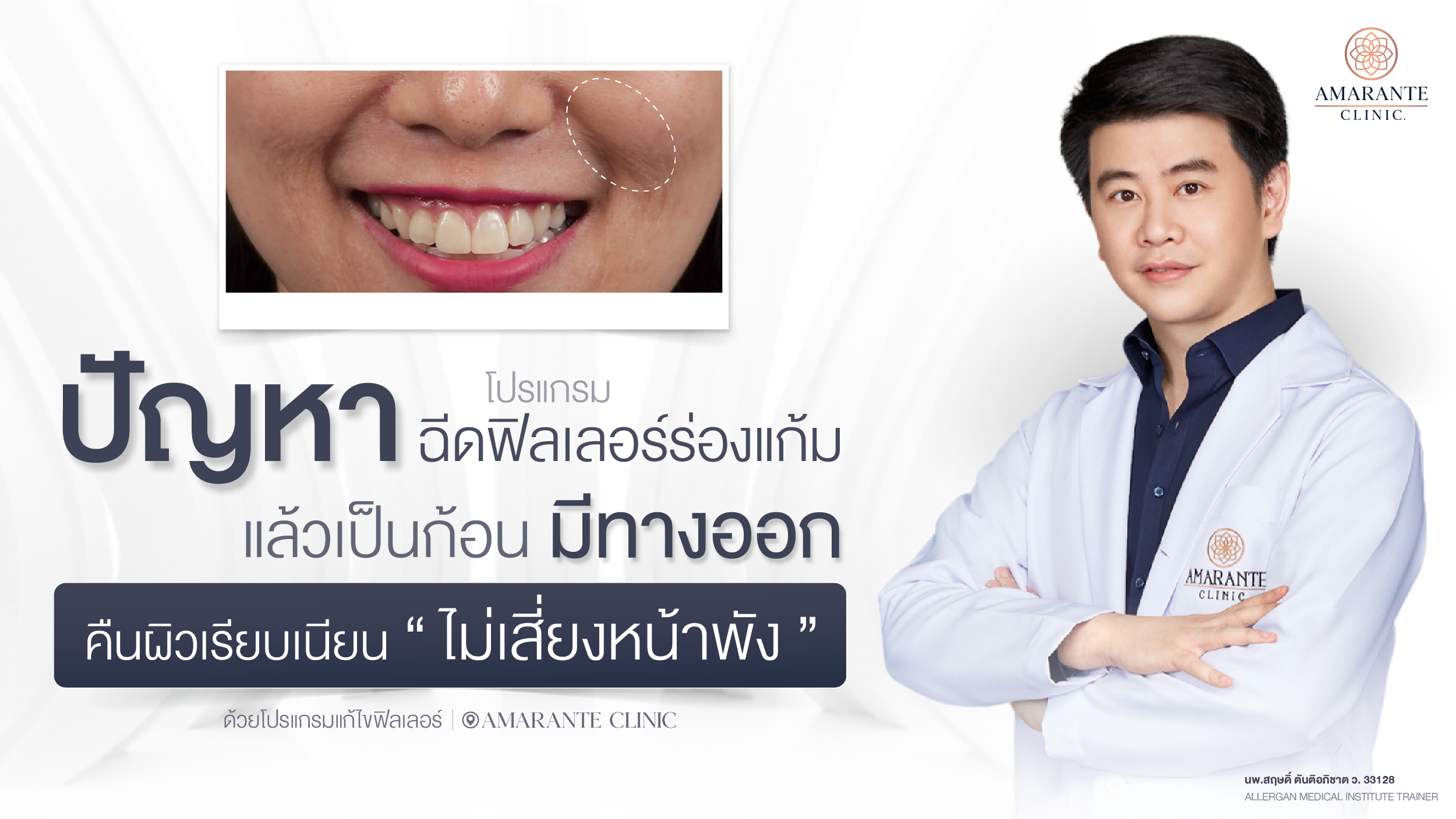 ปกภาพบทความ ฉีดฟิลเลอร์ร่องแก้มแล้วเป็นก้อน แก้ไขฟิลเลอร์อย่างไรดีไม่ให้หน้าพัง