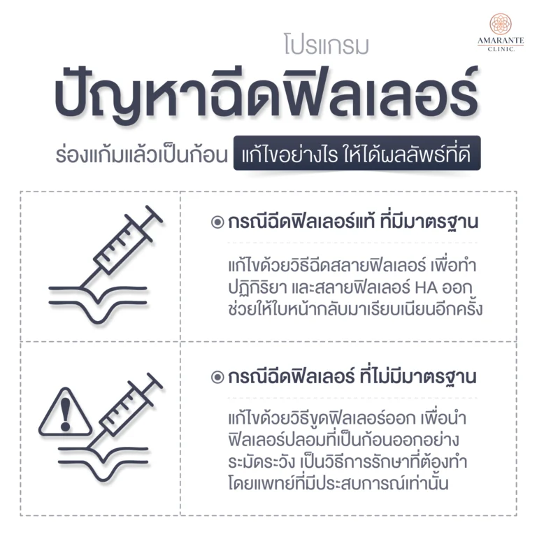 วิธีแก้ไขฟิลเลอร์ร่องแก้มเป็นก้อน ทำอย่างไรบ้าง