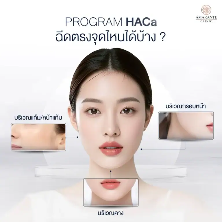 Program HACa Hybrid Filler สร้างกรอบหน้าให้คมชัด คุณภาพผิวดียิ่งขึ้น