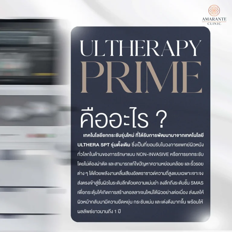 Ulthera Prime คืออะไร