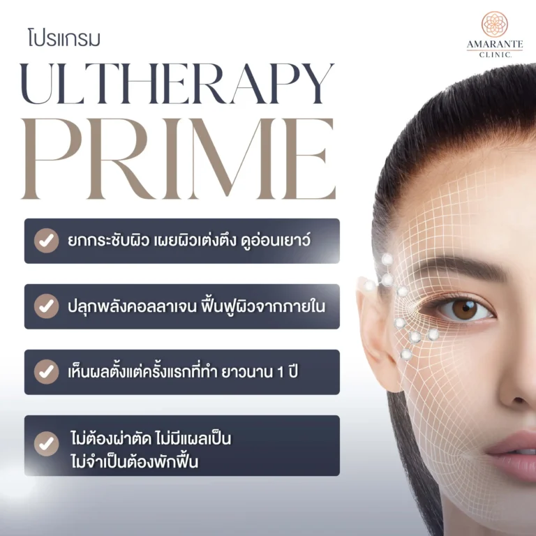 Ulthera Prime ดีอย่างไร
