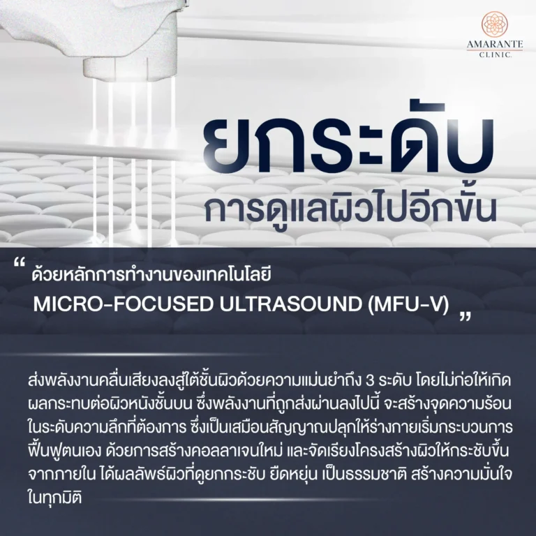 หลักการทำงาน Ulthera Prime
