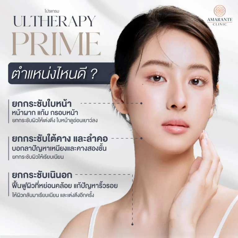 ตำแหน่งไหนเหมาะกับการทำ Ulthera Prime
