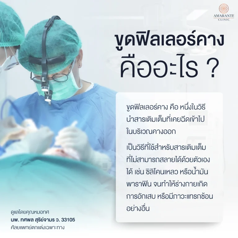 ขูดฟิลเลอร์คาง คืออะไร