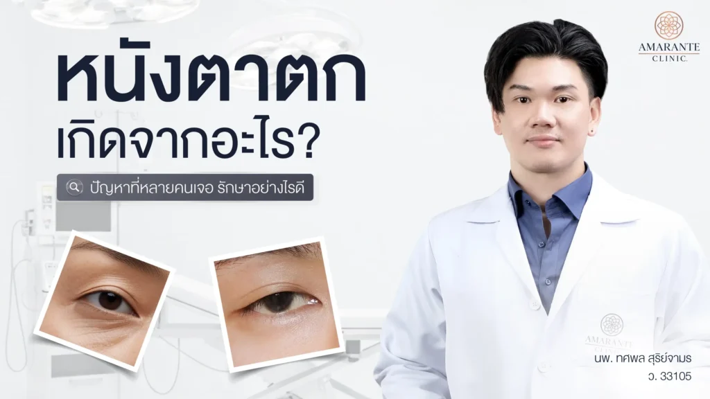 หนังตาตก สาเหตุเกิดจากอะไร