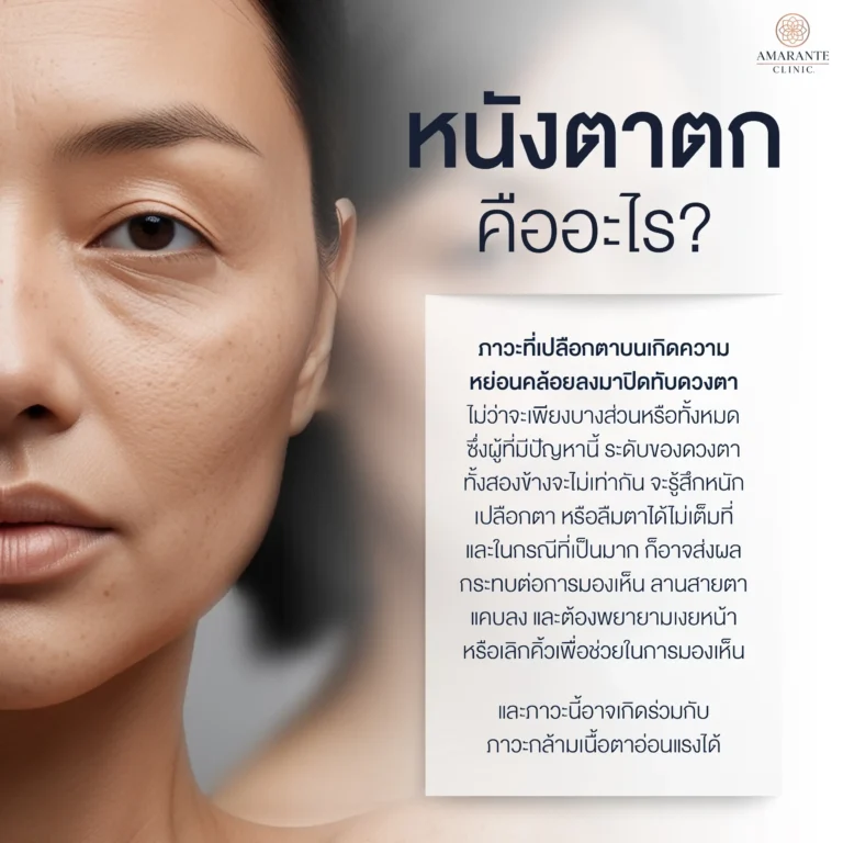 หนังตาตก คืออะไร