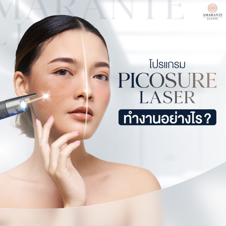 PicoSure Laser ทำงานอย่างไร