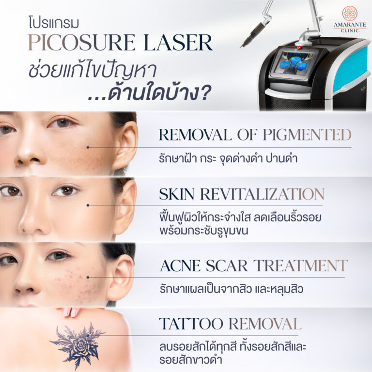 PicoSure Laser ช่วยแก้ไขปัญหาด้านใดบ้าง