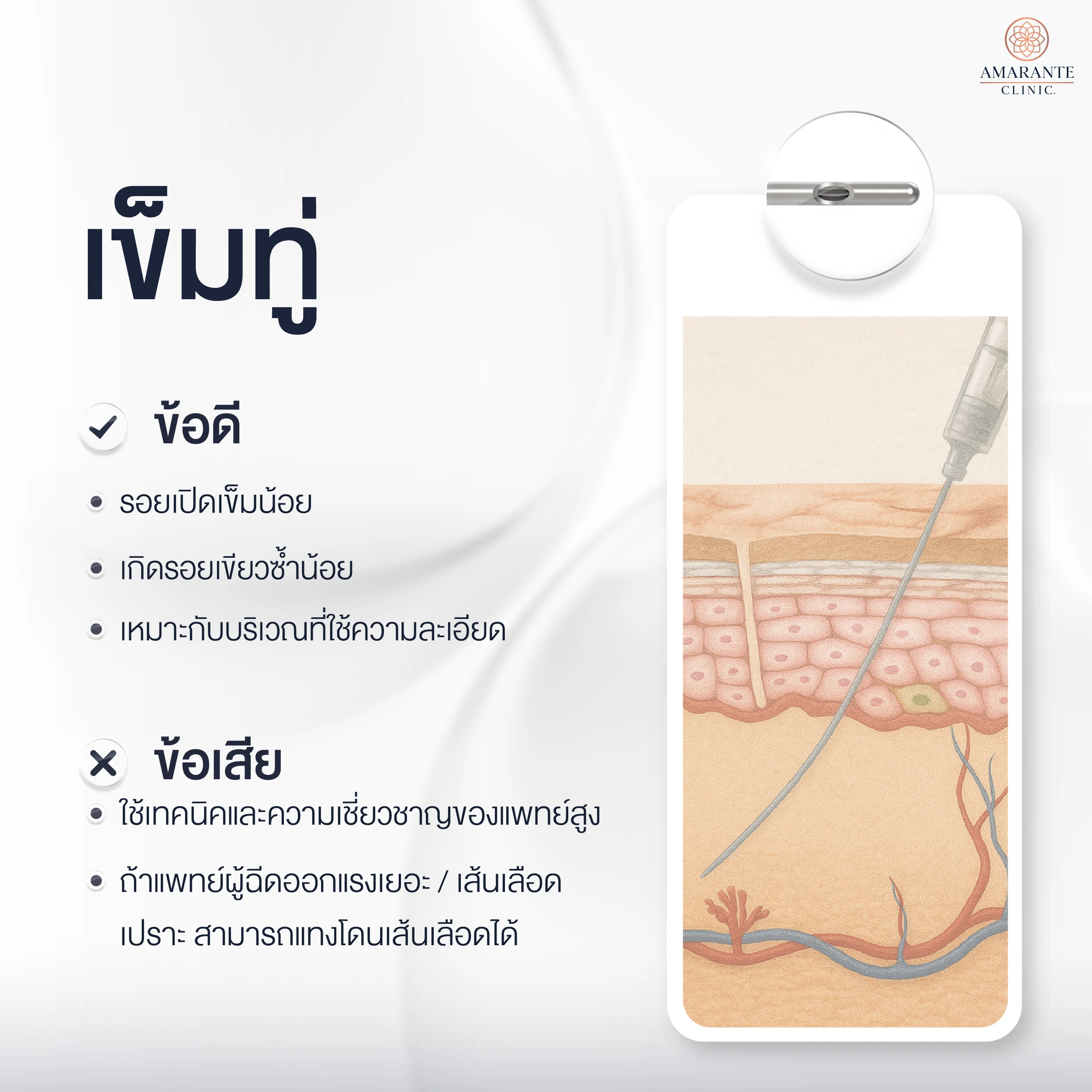 เข็มฉีดฟิลเลอร์ใต้ตาแบบทู่