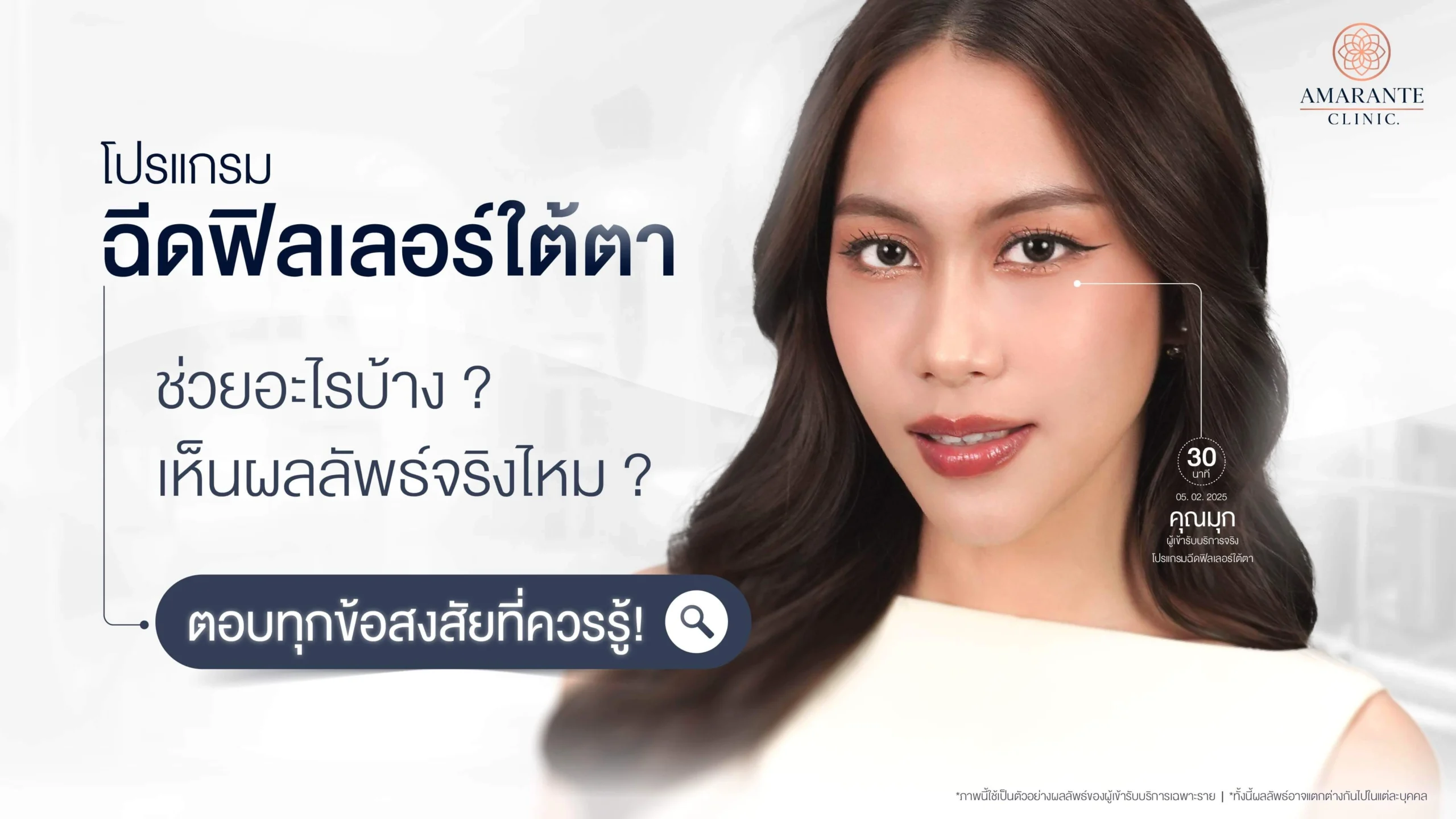 ฉีดฟิลเลอร์ใต้ตาช่วยอะไรบ้าง