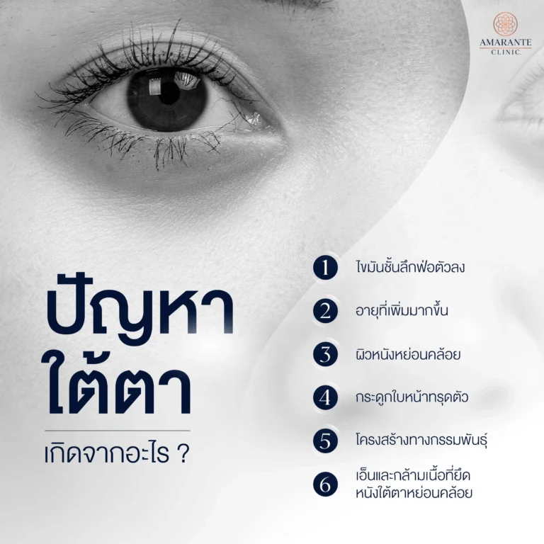 ปัญหาและสาเหตุของการเกิดถุงใต้ตา