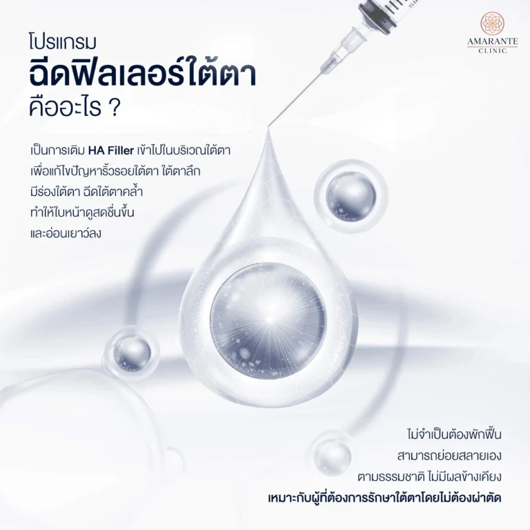 ฟิลเลอร์ใต้ตา คืออะไร?