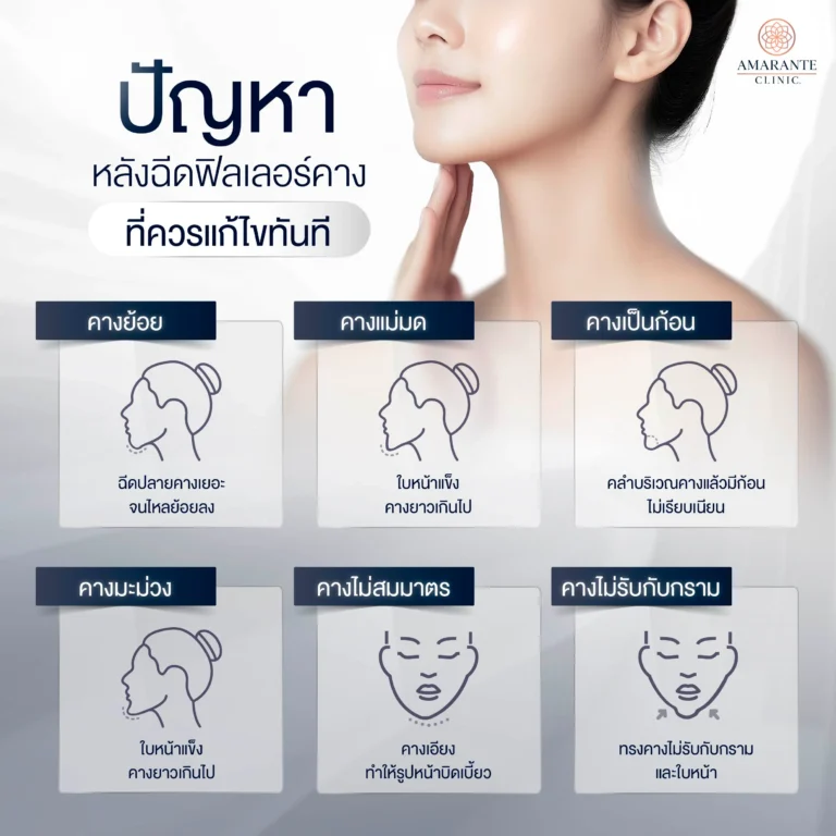 ปัญหาหลังฉีดฟิลเลอร์คางที่ควรแก้ไขทันที
