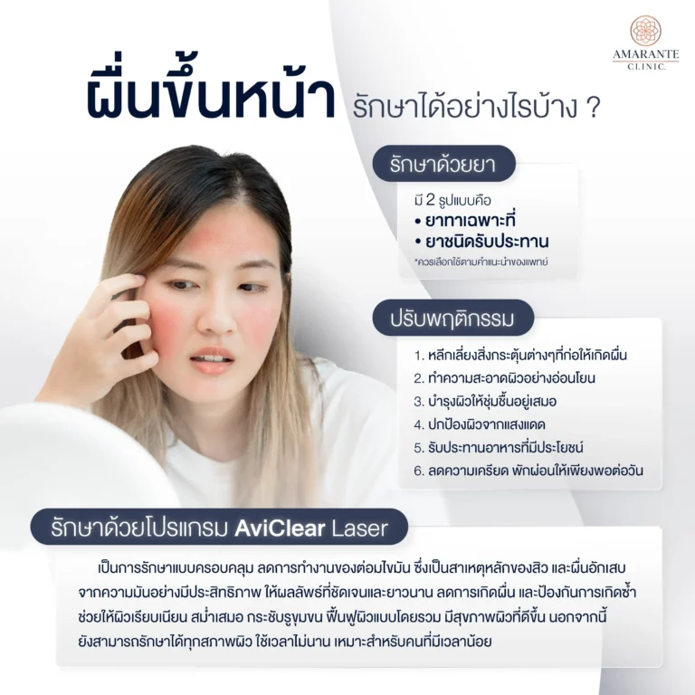 ผื่นขึ้นหน้ารักษาได้อย่างไรบ้าง