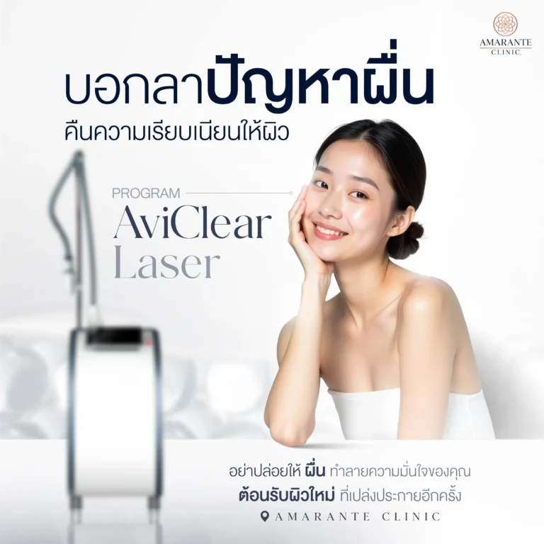 ภาพโฆษณา แก้ปัญหารอยผื่นที่หน้าด้วย Aviclear ที่ Amarante Clinic