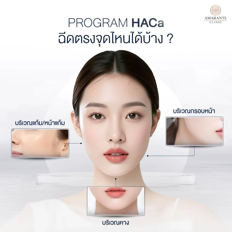 Program HACa ฉีดตรงจุดไหนได้บ้าง