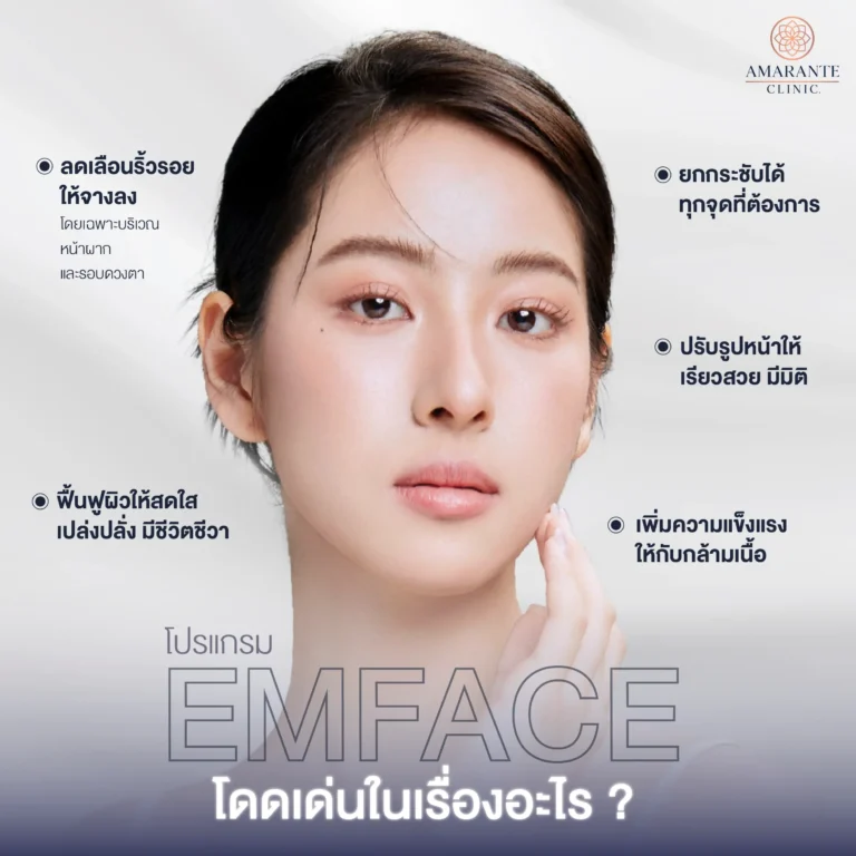 Emface เด่นในเรื่องอะไรได้บ้าง?