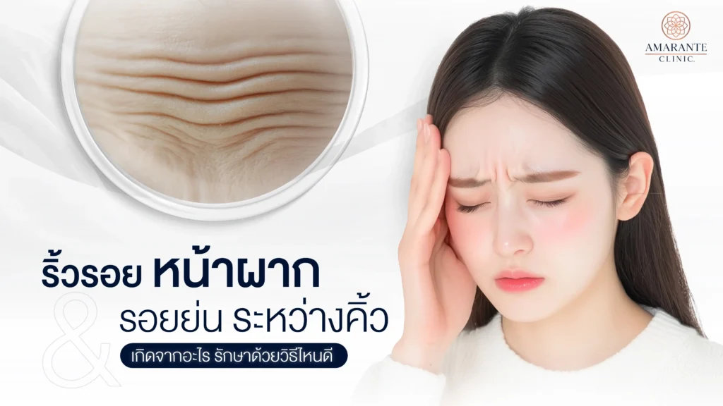 ริ้วรอยหน้าผาก รอยย่นระหว่างคิ้ว เกิดจากสาเหตุใด