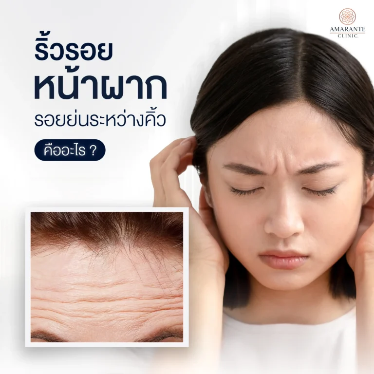 ริ้วรอยหน้าผาก รอยย่นระหว่างคิ้ว คืออะไร