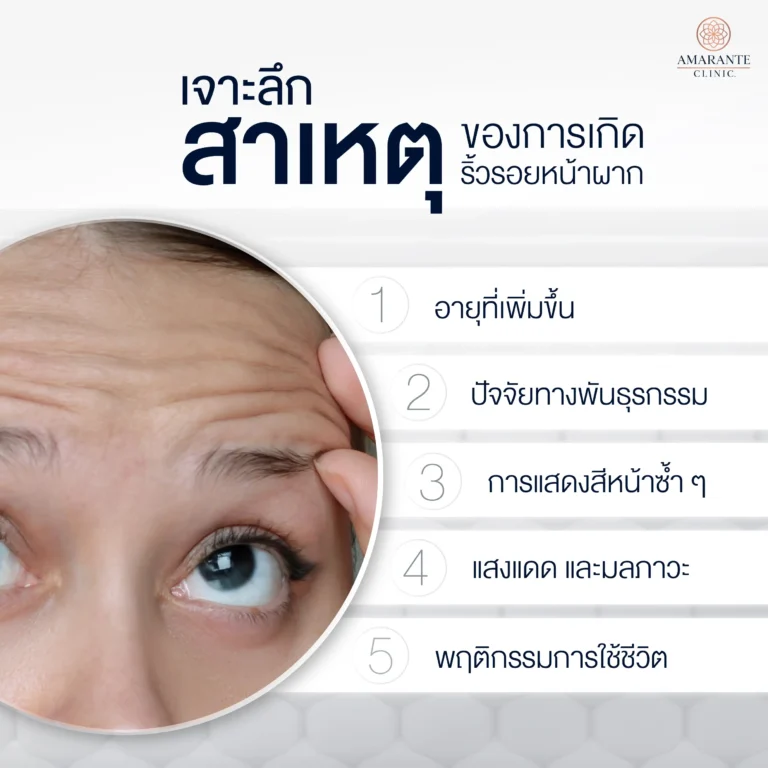 ริ้วรอยหน้าผาก เกิดจากสาเหตุอะไร