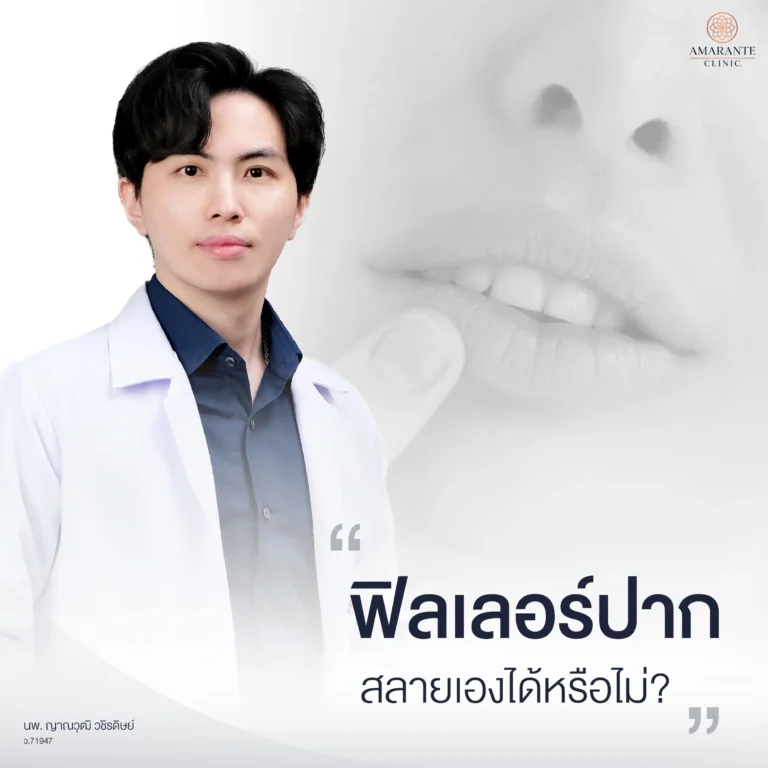 ฟิลเลอร์ปาก สลายเองได้ไหม