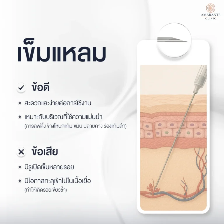 เข็มฉีดฟิลเลอร์แบบแหลม