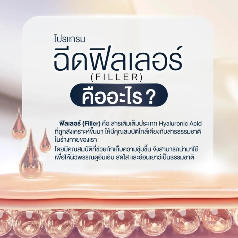 ฟิลเลอร์ (Filler) คืออะไร?