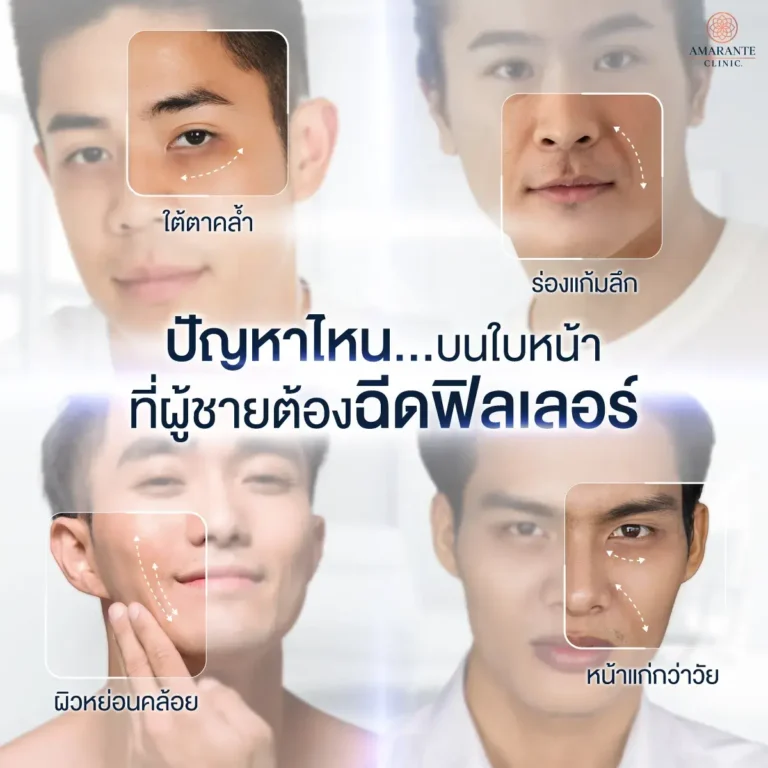 ปัญหาไหนบนใบหน้าของคุณผู้ชายที่ต้องฉีดฟิลเลอร์