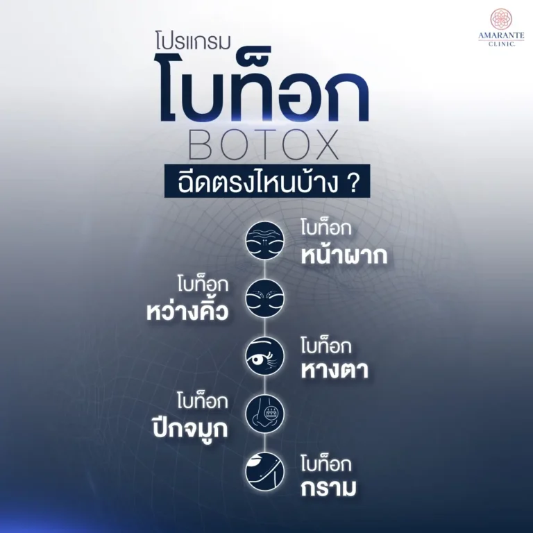 โบท็อก (Botox) ฉีดตรงไหน