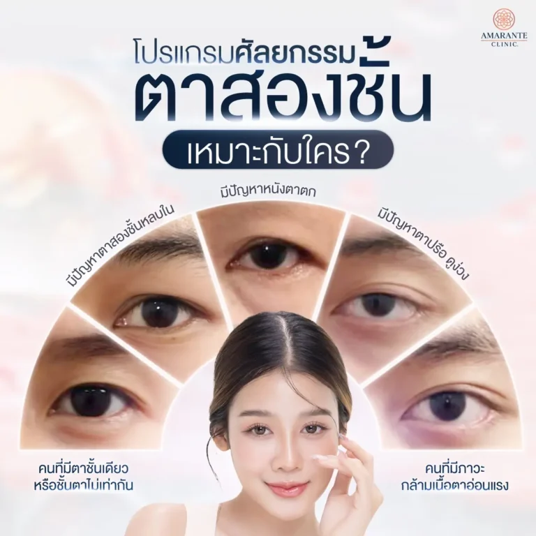 ศัลยกรรมตาสองชั้น เหมาะกับใครบ้าง