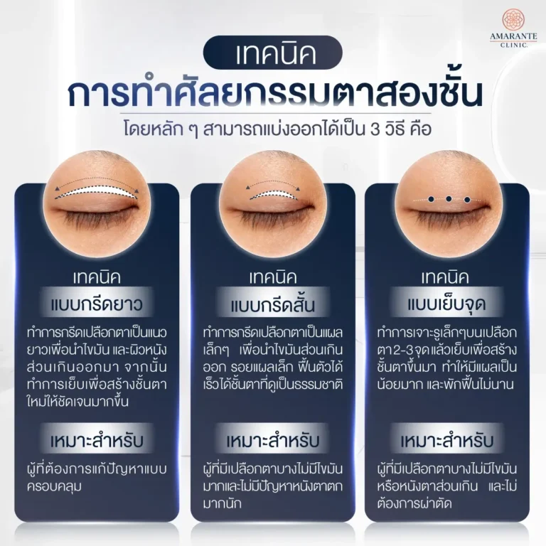 เทคนิคทำศัลยกรรมตาสองชั้น มีกี่วิธี มีข้อดี-ข้อเสียอย่างไร