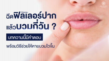 ฉีดฟิลเลอร์ปากแล้วบวมกี่วัน