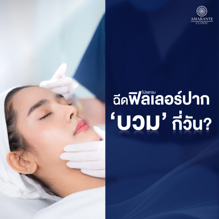 ฉีดฟิลเลอร์ปากบวมกี่วัน?