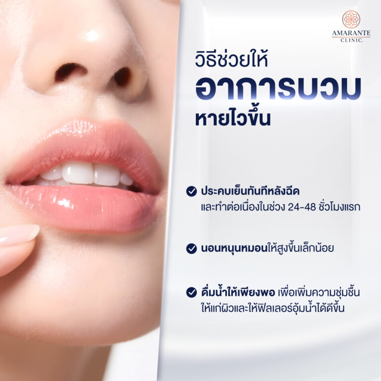 วิธีช่วยให้อาการบวมหายไวขึ้น