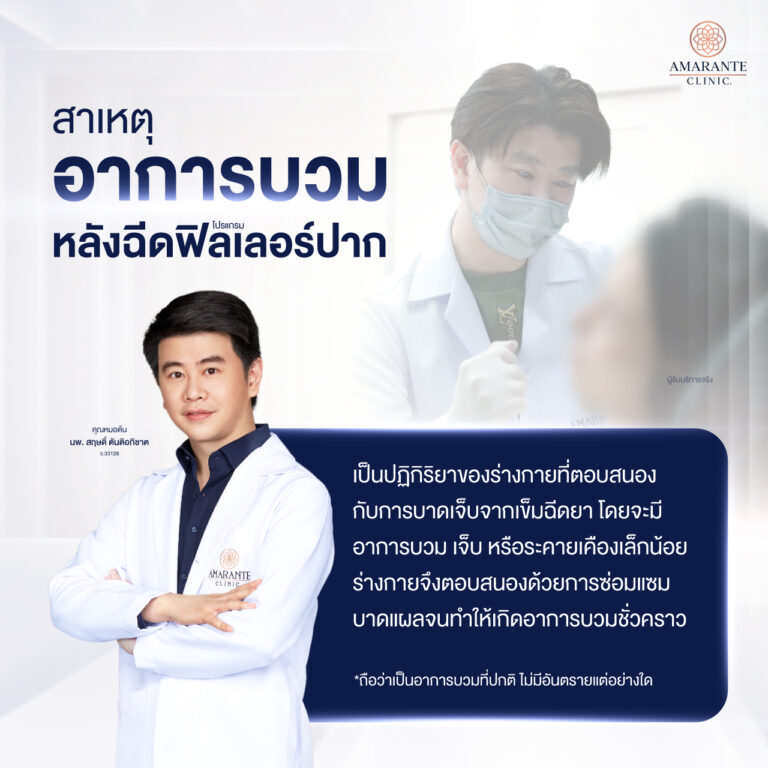 สาเหตุของอาการบวมหลังฉีดฟิลเลอร์ปาก